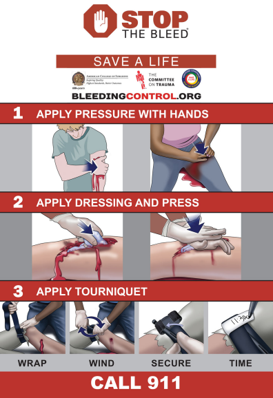 dom Andet Evakuering Stop the Bleed: When to apply pressure, pack, or tourniquet 